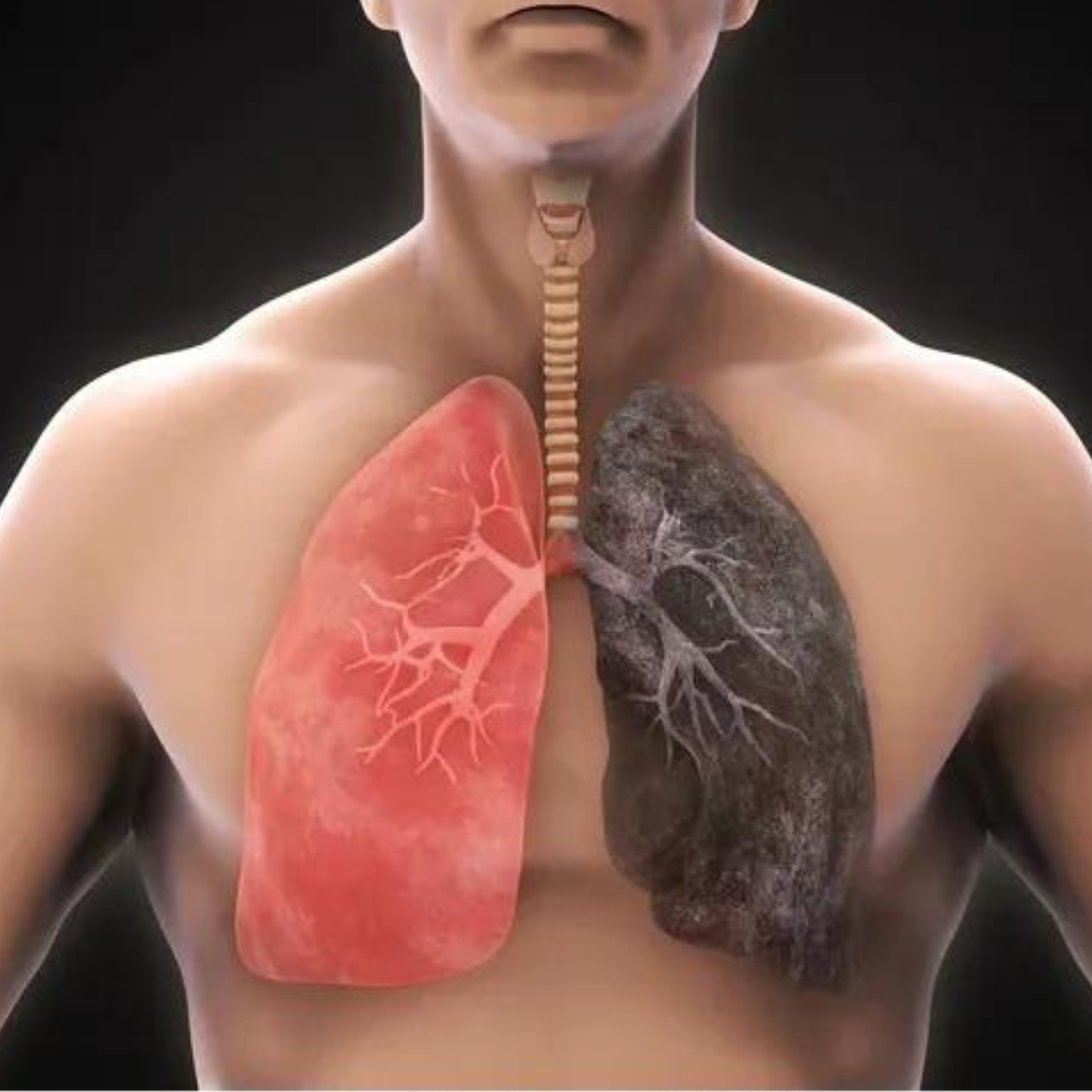 respiratory disorder