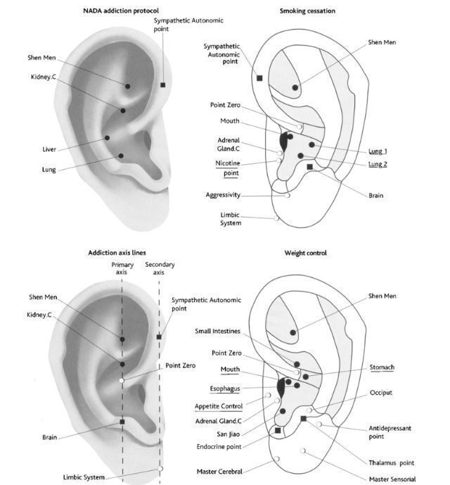 Auricular therapy side effects acuhealth ear acupunture