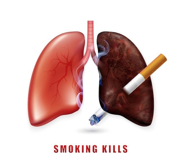 Natural Breathing Relief Products (lung cancer)